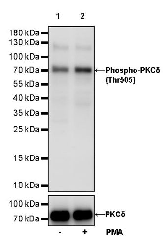 Phospho-PKCδ (Thr505) Recombinant Rabbit mAb (S-1668-89)