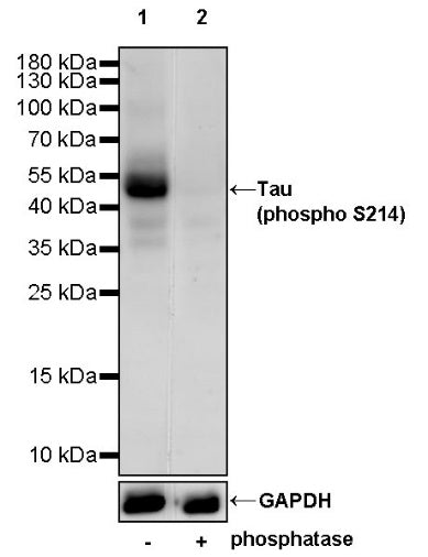 Tau (phospho S214) Recombinant Rabbit mAb (S-1032-326)