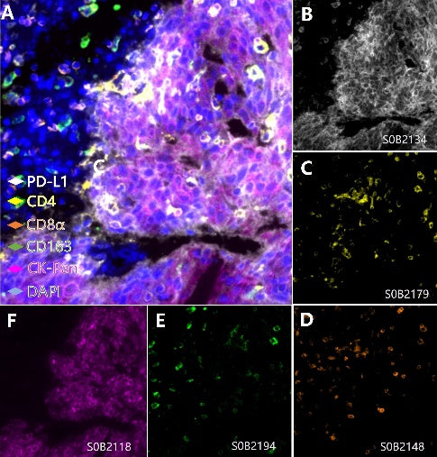 PD-L1, CK-Pan, CD8α, CD4, CD163 Antibody Panel