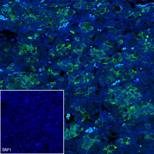 Prolactin/PRL Recombinant Rabbit mAb (S-235-215)