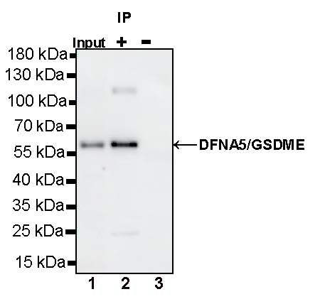 DFNA5/GSDME Recombinant Rabbit mAb (S-1703-1)