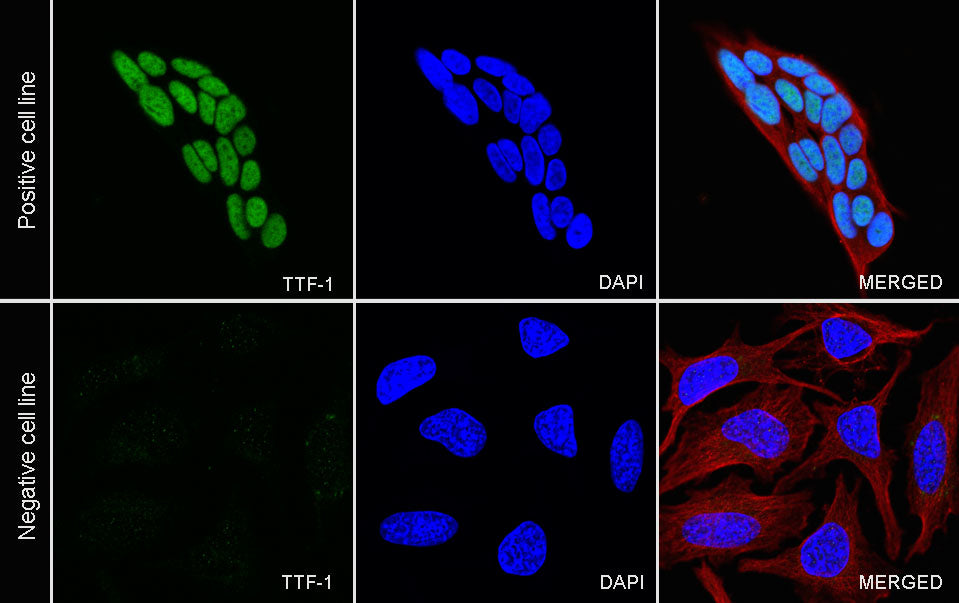 S-RMab® TTF-1 Recombinant Rabbit mAb (SDT-R097)