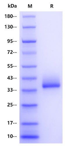 Mycobacterium tuberculosis fbpB/Ag85B Protein, His Tag