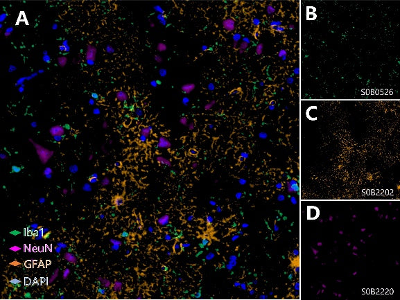 Microglia, Mature Neuron and Astrocyte Marker (Iba1, NeuN, GFAP) Antibody Panel