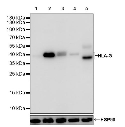HLA-G Recombinant Rabbit mAb (S-2711-78)