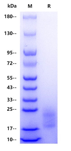 Human TSLP Protein, His tag
