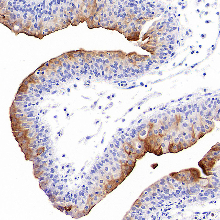 Uroplakin II/UPII Recombinant Rabbit mAb (SDT-6121)