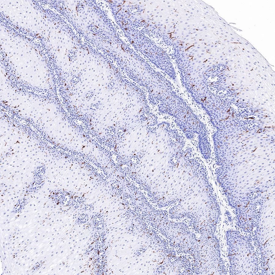CD1A Recombinant Rabbit mAb (SDT-R086)