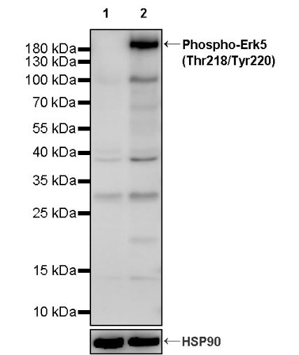 Phospho-Erk5 (Thr218/Tyr220) Recombinant Rabbit mAb (S-3538-42)