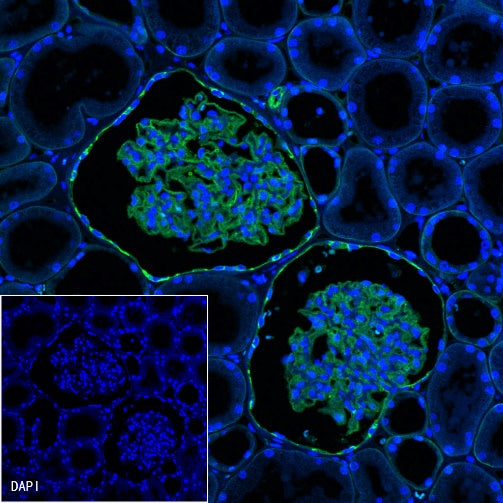 CD239 Recombinant Rabbit mAb (S-683-3)