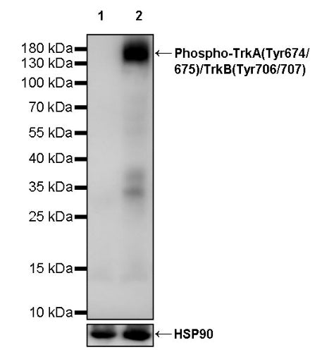 Phospho-TrkA(Tyr674/675)/TrkB(Tyr706/707) Recombinant Rabbit mAb (S-3359)