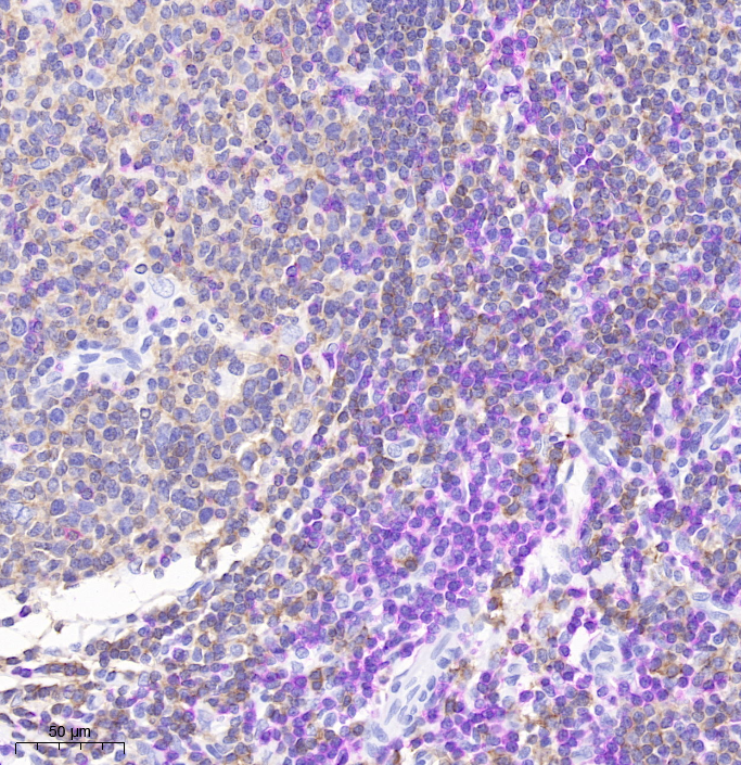 IHC DoubleStain Kit