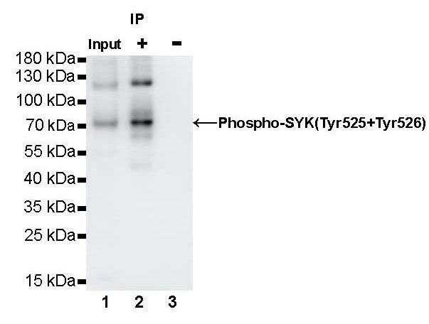 Phospho-Syk (Tyr525/526) Recombinant Rabbit mAb (S-1245-113)