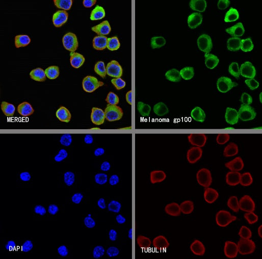 PMEL/Melanoma gp100 Recombinant Rabbit mAb (SDT-3393)