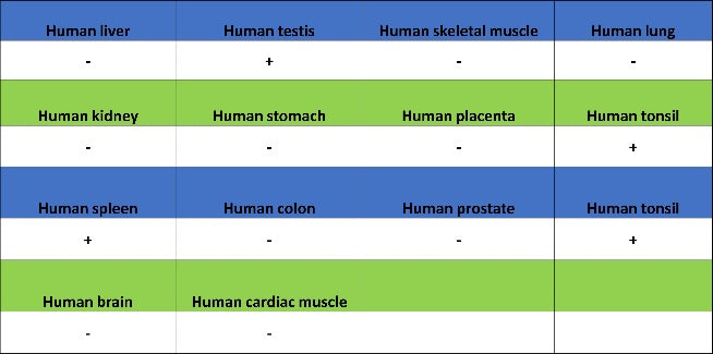 IRF-5 Recombinant Rabbit mAb (S-3056-28)