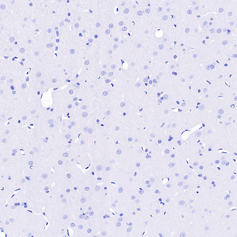 groEL Recombinant Rabbit mAb (S-4634-25)