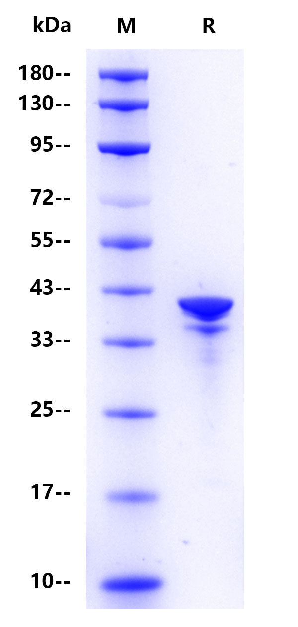 Annexin A1 His Tag Protein, Human