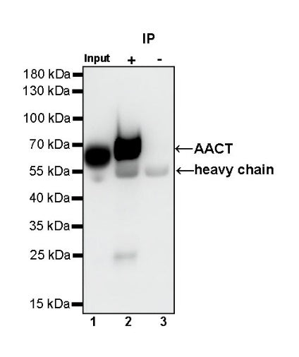 AACT Recombinant Rabbit mAb (S-897-32)