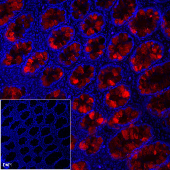 Reg4 Recombinant Rabbit mAb (SDT-1232-23)