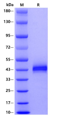 Cathepsin B His tag Protein, Human