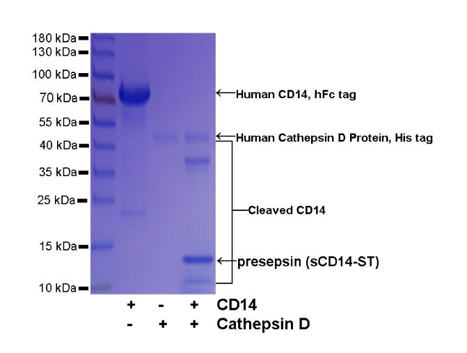 Cathepsin D His Tag Protein, Human