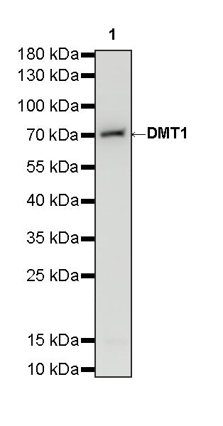DMT1 Recombinant Rabbit mAb