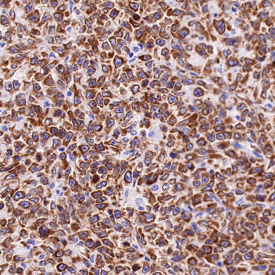 S-RMab® Bcl-2 Recombinant Rabbit mAb,PBS Only (SDT-R160)