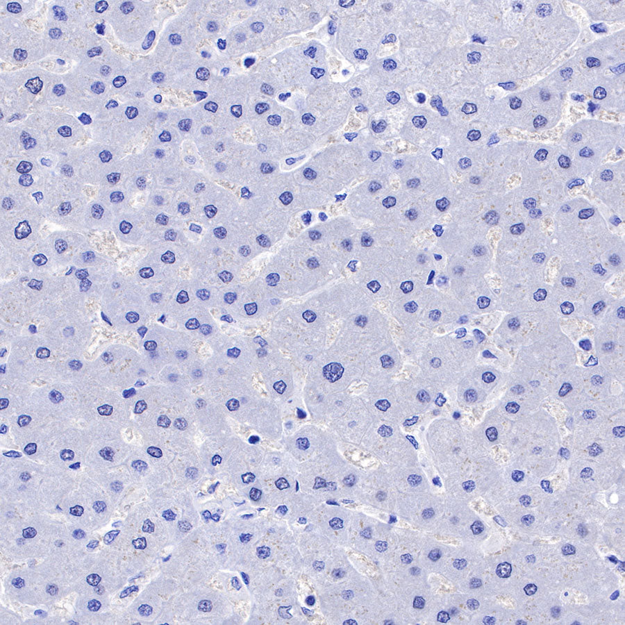 CGB/HCG-β Recombinant Rabbit mAb (SDT-228-46)