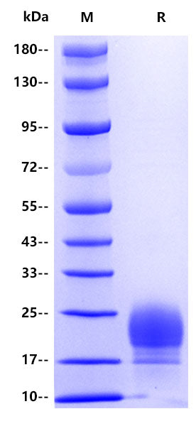 C1q His Tag Protein, Human