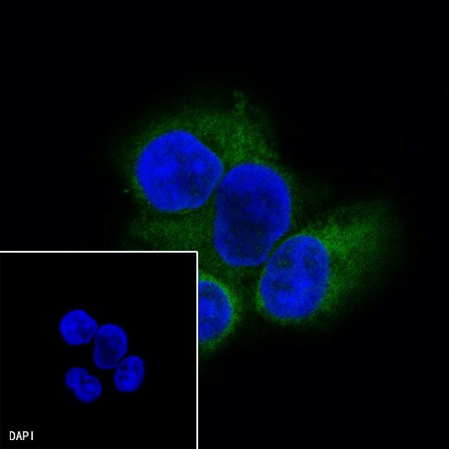ALDH3A1 Recombinant Rabbit mAb (S-R220)