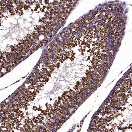 VDAC2 Rabbit Polyclonal Antibody