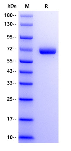 Human IGSF8 Protein, His tag