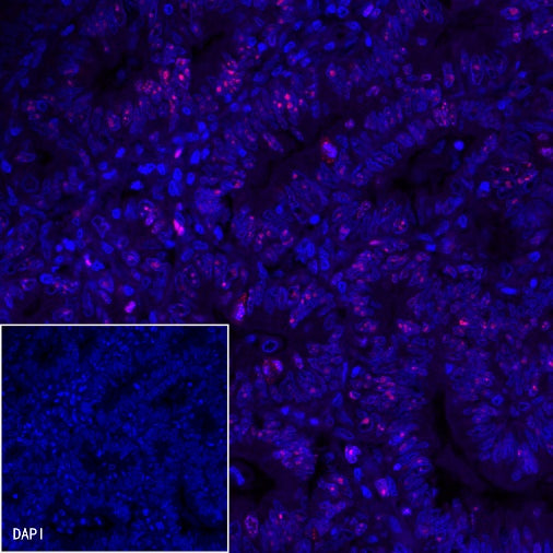 Ki67 Recombinant Mouse mAb (Alexa Fluor® 594 Conjugate) (S-606-7)