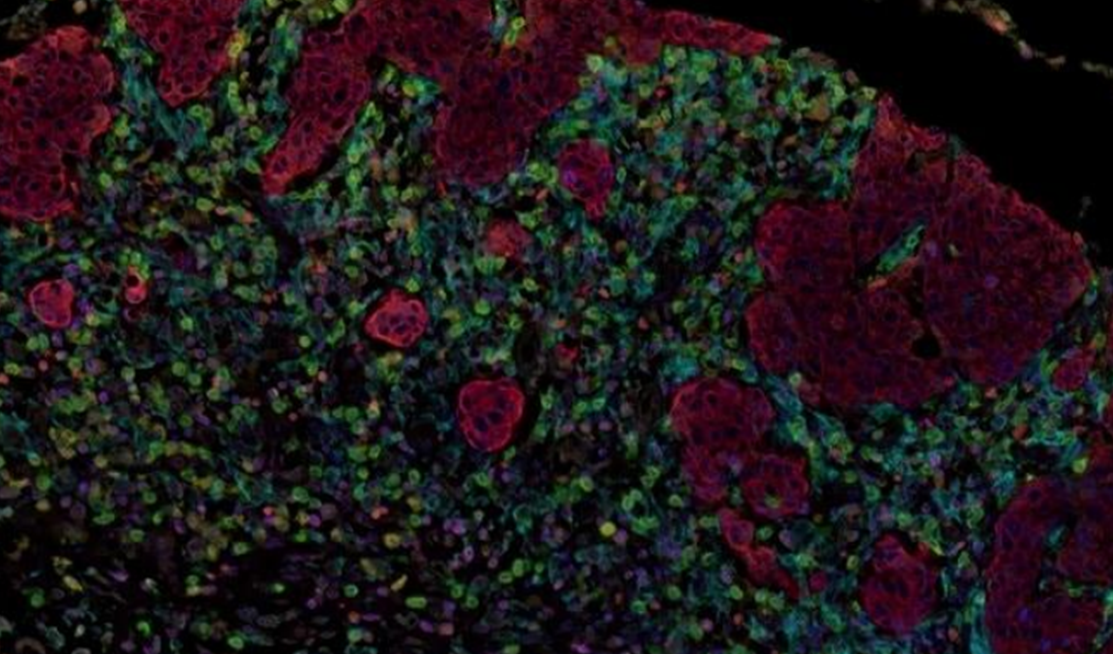 Absin 4-Color IHC Kit (Anti-Rabbit and Mouse Secondary Antibody)