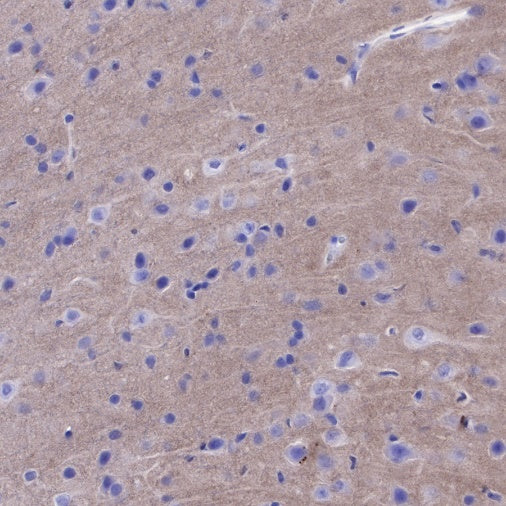 CD90 Recombinant Rabbit mAb (SDT-349-164)