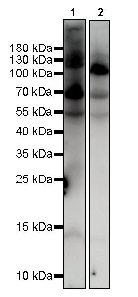 Sulfotyrosine Recombinant mAb (S-5309)