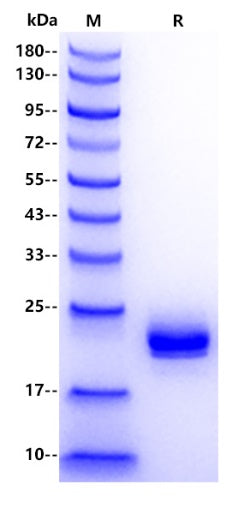 Mouse IFN-alpha1 Protein, His Tag