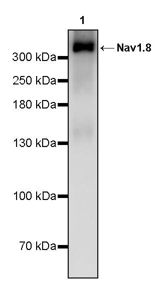 Nav1.8 Recombinant Rabbit mAb (S-3631-104)