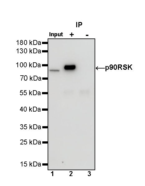 p90RSK Recombinant Rabbit mAb (S-1024-26)