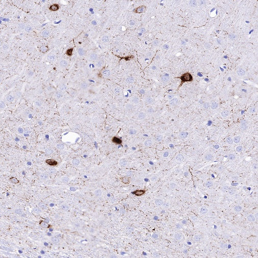 Neuropeptide Y Recombinant Rabbit mAb (S-1104-18)