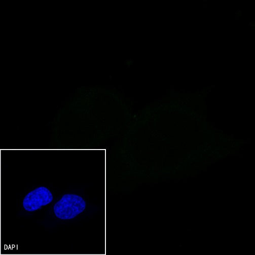 cGAS Recombinant Rabbit mAb (S-708-15)