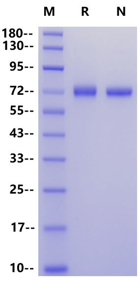 H1N1 HA (A/WSN/1933) His Tag Protein