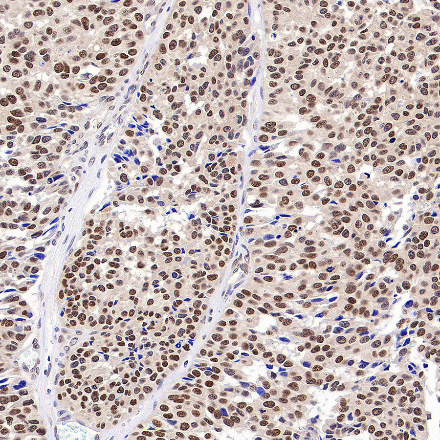 hnRNP A1 Recombinant Rabbit mAb