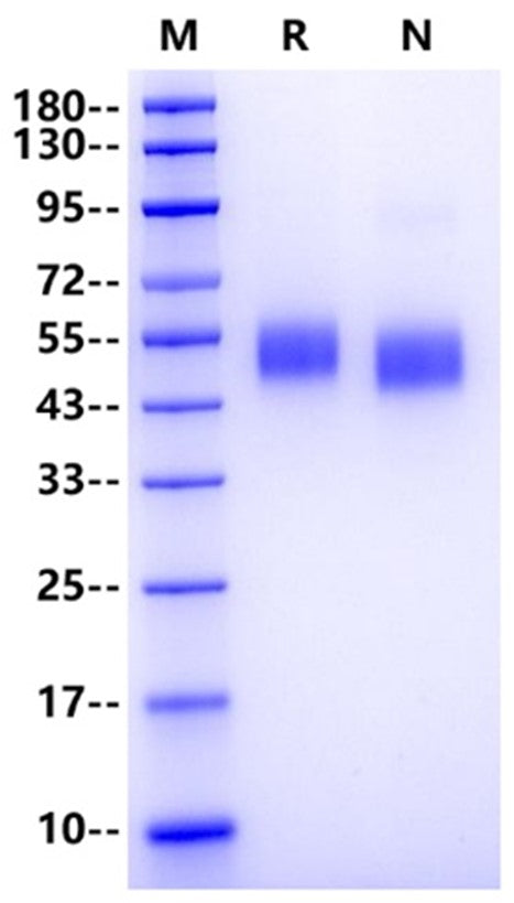 H1N1 HA1 (A/Brevig Mission/1/1918) His Tag Protein