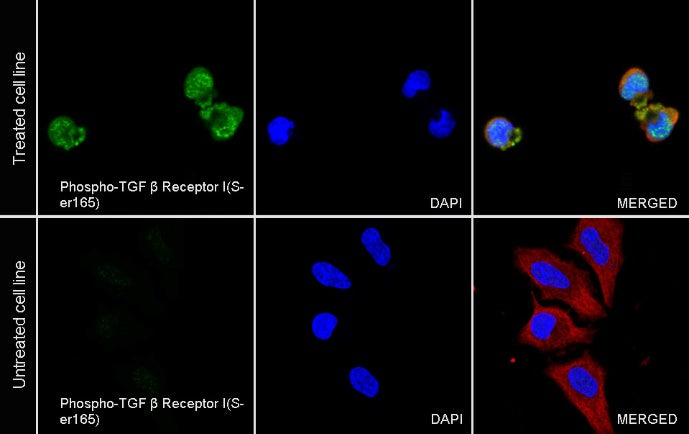 Phospho-TGF β Receptor I(Ser165) Recombinant Rabbit mAb (S-1896-21)