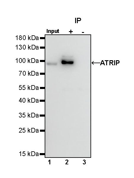 ATRIP Recombinant Rabbit mAb (S-1275-48)
