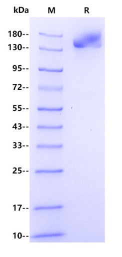 Rat Alpha-2-Macroglobulin Protein, His tag