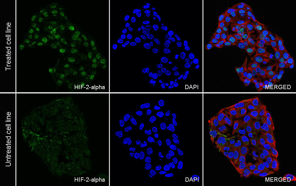 HIF-2 alpha Recombinant Rabbit mAb (S-5326)