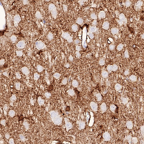 NDRG2 Recombinant Rabbit mAb (S-618-76)