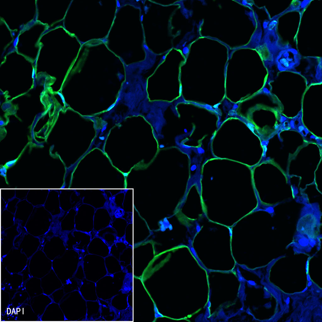 FABP4 Recombinant Rabbit mAb (S-1360-58)